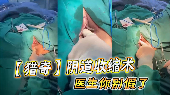 【猎奇】阴道收缩术，医生你别假了